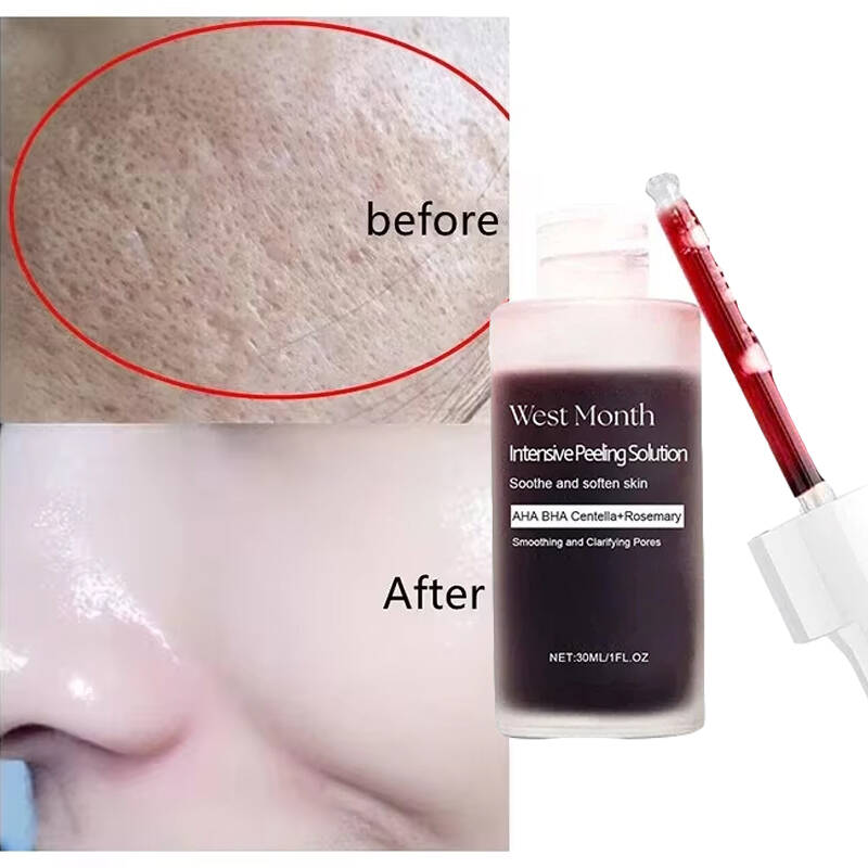 Tranexamic Acid Serum - Sembra seta, ha l'aspetto di un