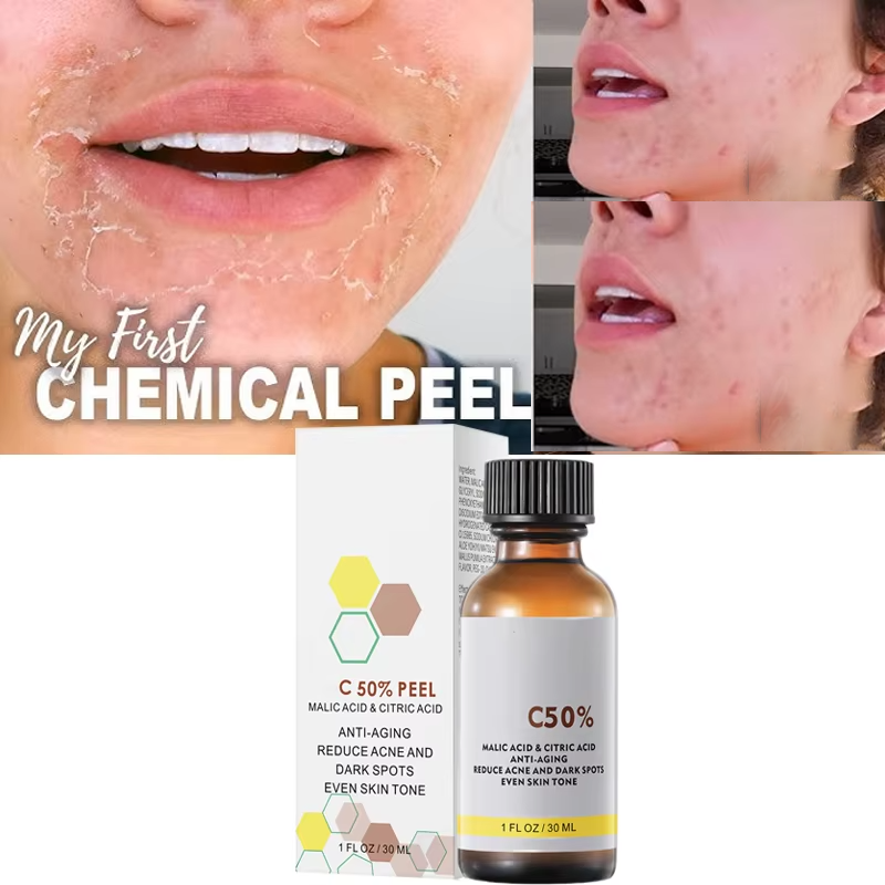 Tranexamic Acid Serum - Con acido malico e acido citrico