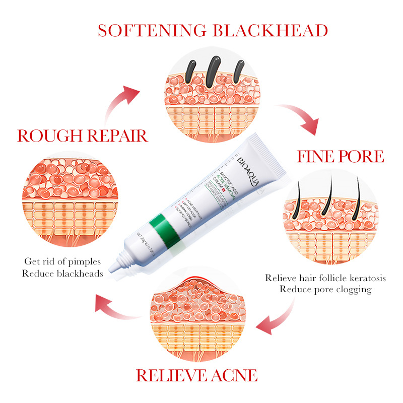 1/2/3pcs BIOAQUA Crema per il  - Azelaic Acid Cream recensione e prezzo