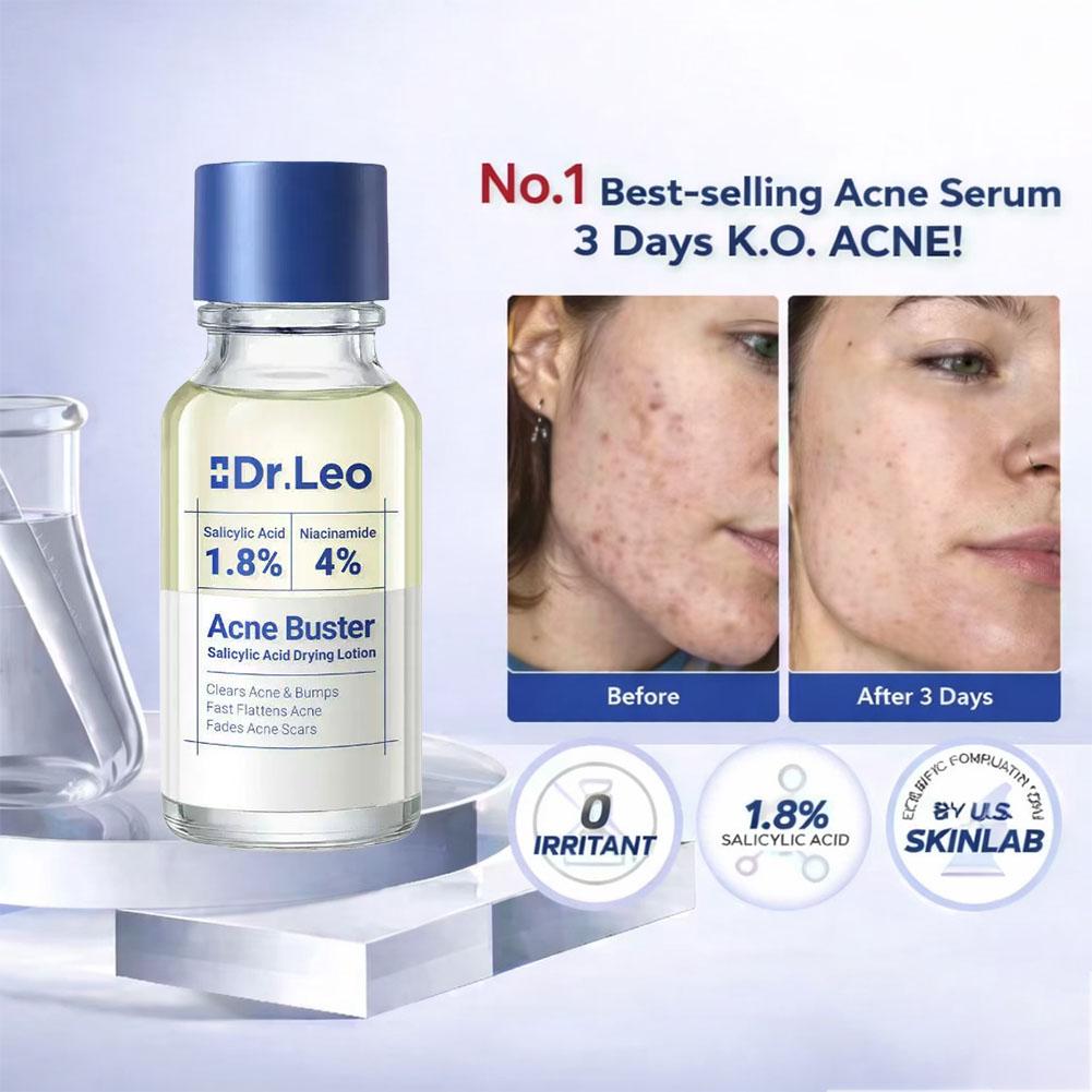 Lozione Trattamento all'Acido  - Tranexamic Acid Serum recensione e prezzo