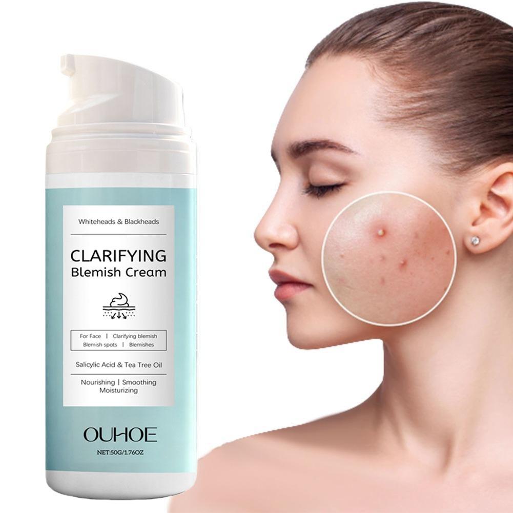 Crema viso all'acido salicilic - Azelaic Acid Cream recensione e prezzo