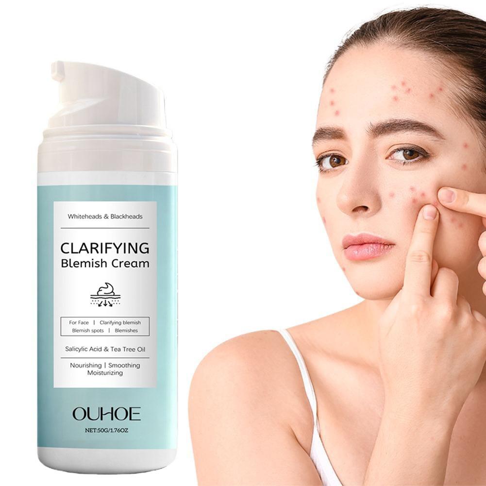 Crema viso all'acido salicilic - Azelaic Acid Cream recensione e prezzo